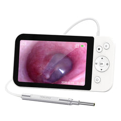 Teslong MS500 5 Inch HD Screen Illuminated Ear Pickers 3.9mm Diameter Visual Ear Care Tool, MS500